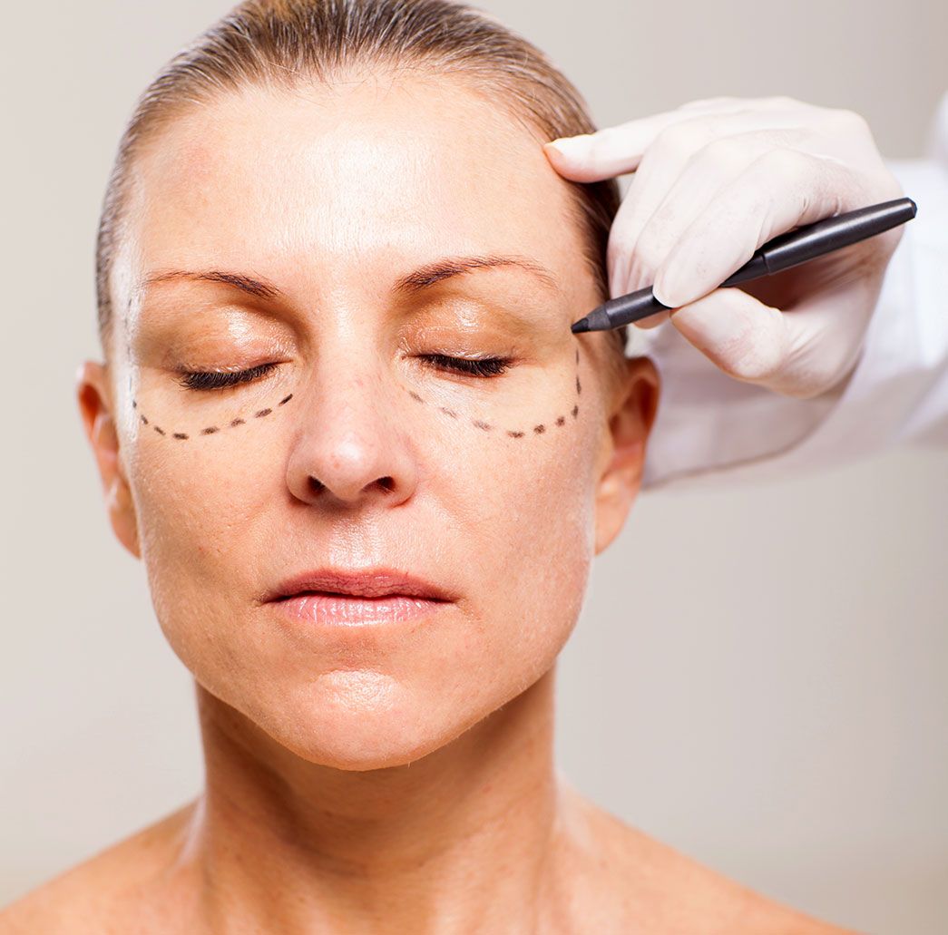 OP-Markierung im Gesicht